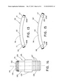 METHOD FOR OPEN SURGICAL PLACEMENT diagram and image