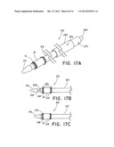 METHOD FOR OPEN SURGICAL PLACEMENT diagram and image