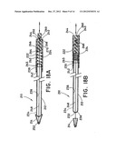 METHOD FOR OPEN SURGICAL PLACEMENT diagram and image