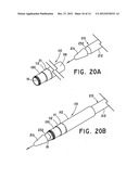 METHOD FOR OPEN SURGICAL PLACEMENT diagram and image