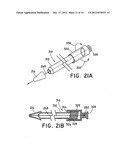 METHOD FOR OPEN SURGICAL PLACEMENT diagram and image