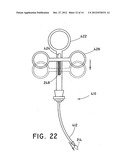 METHOD FOR OPEN SURGICAL PLACEMENT diagram and image