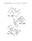 METHOD FOR OPEN SURGICAL PLACEMENT diagram and image