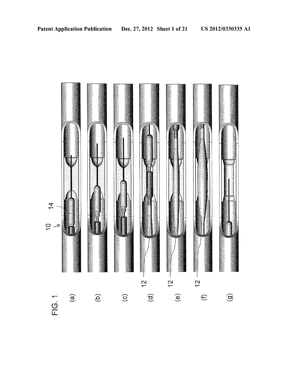 PERCUSSION TOOL FOR BREACHING INTRAVASCULAR OCCLUSIONS - diagram, schematic, and image 02