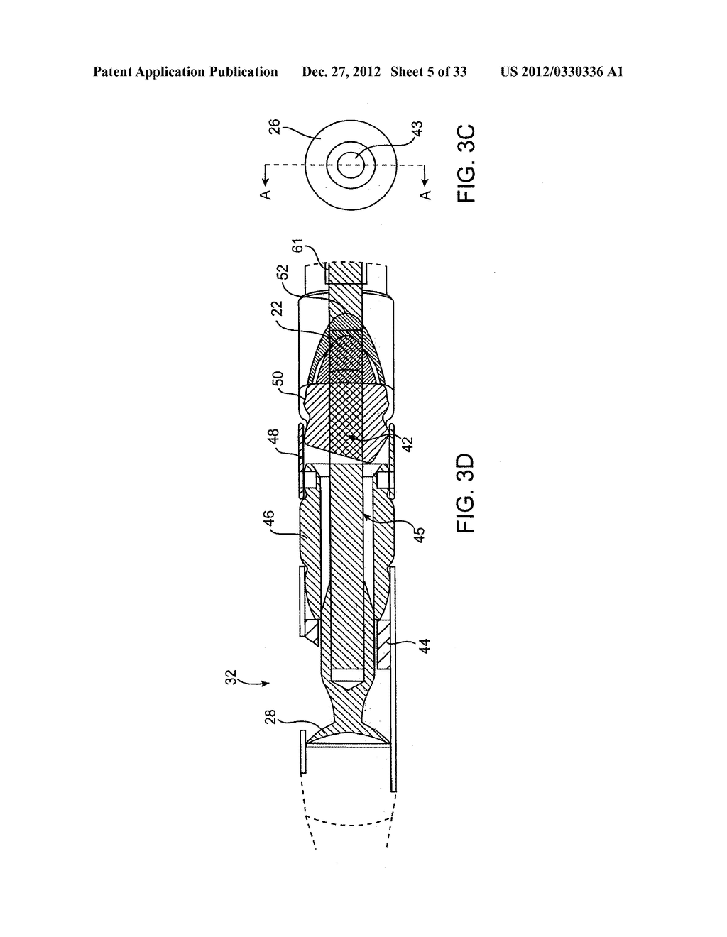 DEBULKING CATHETERS AND METHODS - diagram, schematic, and image 06