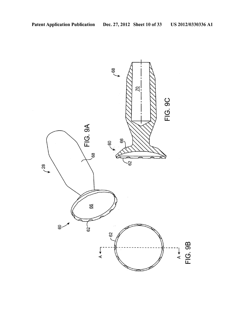 DEBULKING CATHETERS AND METHODS - diagram, schematic, and image 11