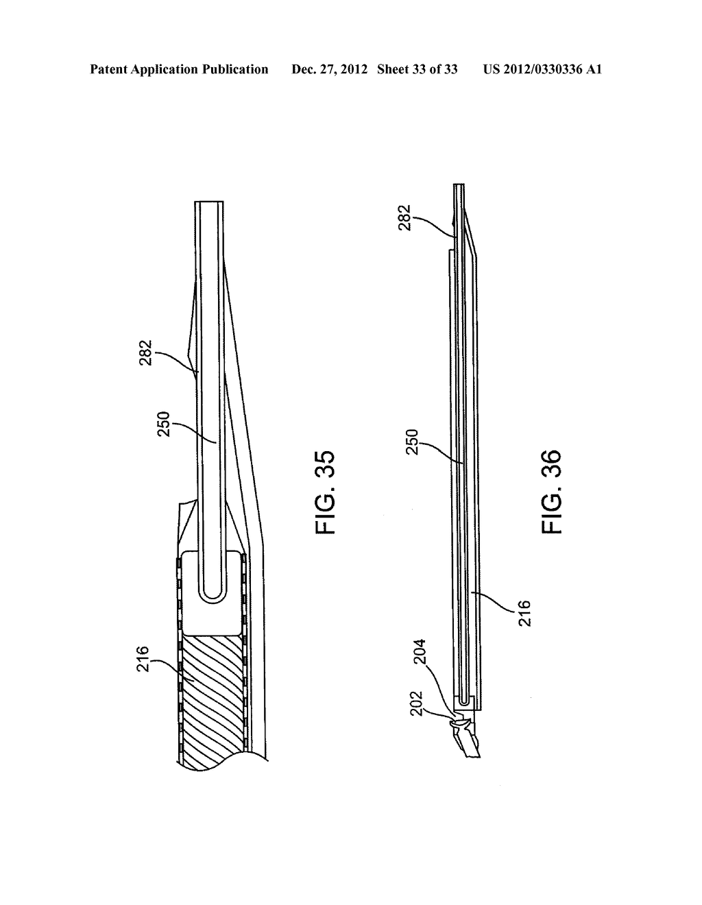 DEBULKING CATHETERS AND METHODS - diagram, schematic, and image 34