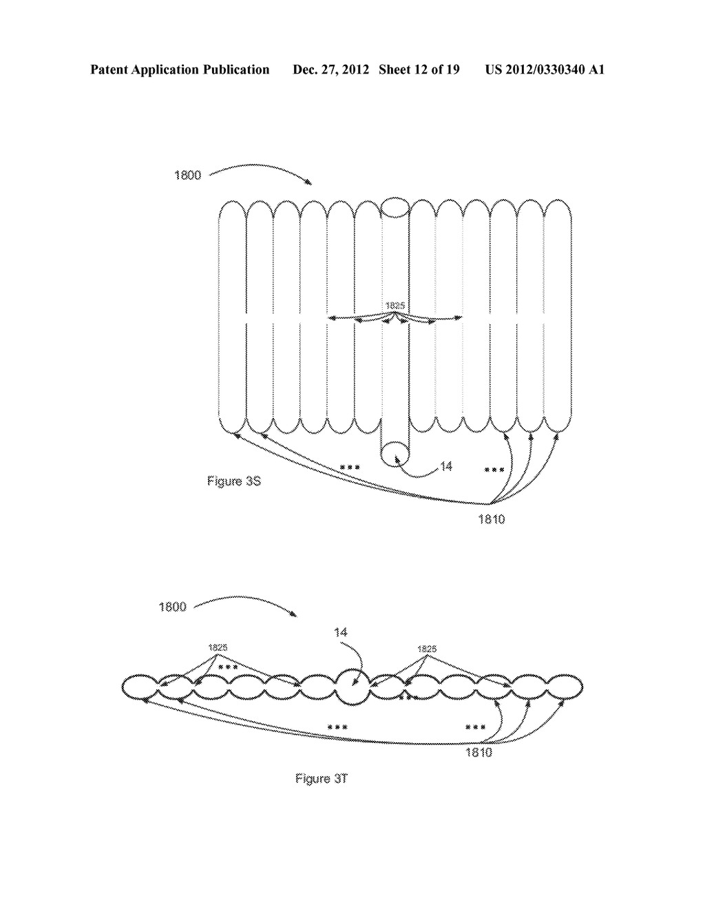 CONTROLLED TISSUE DISSECTION SYSTEMS AND METHODS - diagram, schematic, and image 13