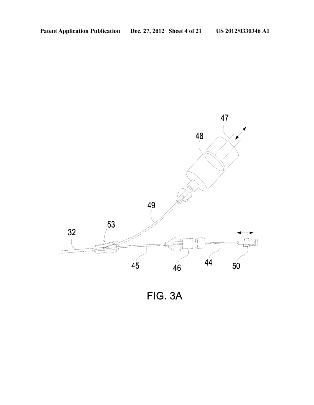 INTEGRATED DISTAL EMBOLIZATION PROTECTION APPARATUS FOR ENDO-LUMINAL     DEVICES SUCH AS BALLOON, STENT OR TAVI APPARATUS - diagram, schematic, and image 05