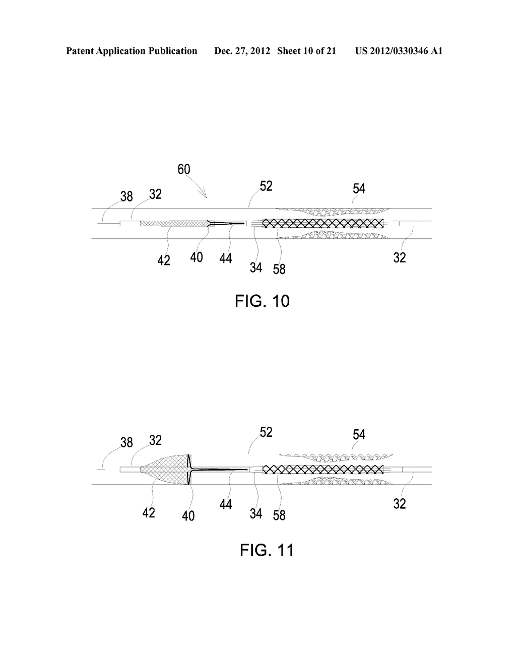 INTEGRATED DISTAL EMBOLIZATION PROTECTION APPARATUS FOR ENDO-LUMINAL     DEVICES SUCH AS BALLOON, STENT OR TAVI APPARATUS - diagram, schematic, and image 11