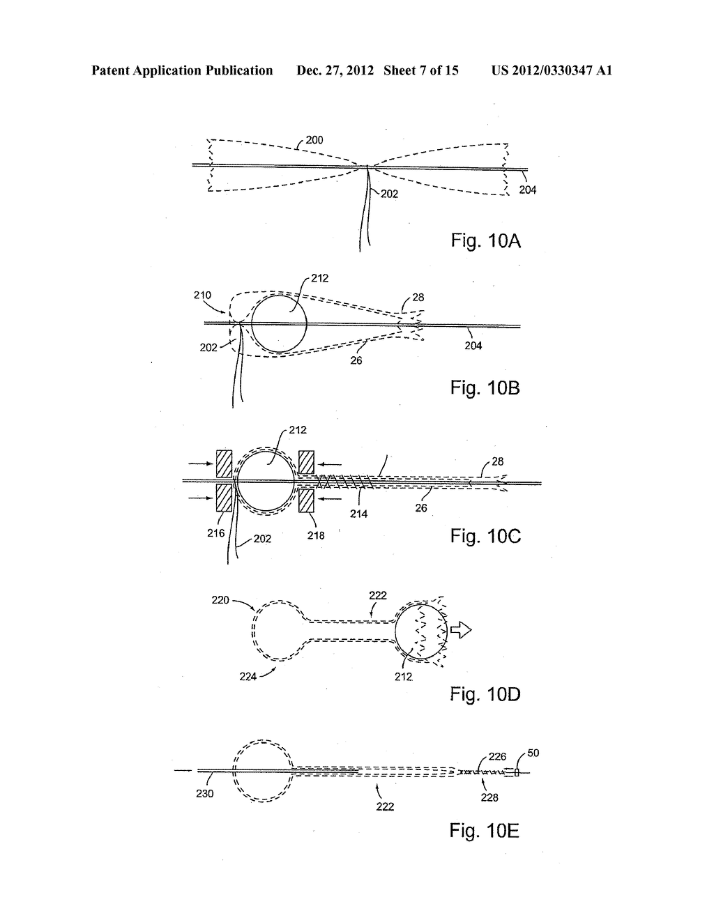 Multiple Layer Filamentary Devices for Treatment of Vascular Defects - diagram, schematic, and image 08