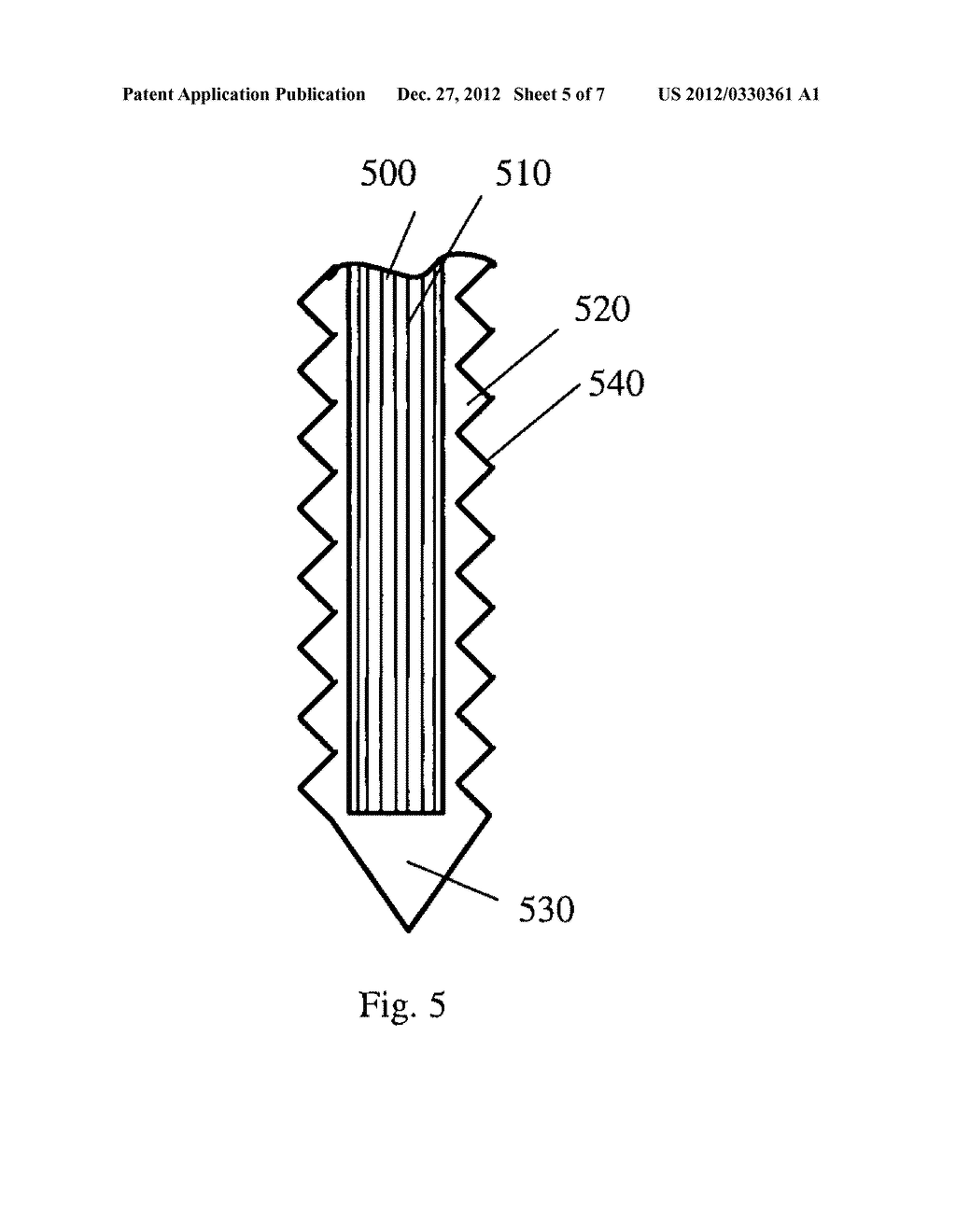 SPINAL IMPLANTABLE DEVICES MADE OF CARBON COMPOSITE MATERIALS AND USE     THEREOF - diagram, schematic, and image 06