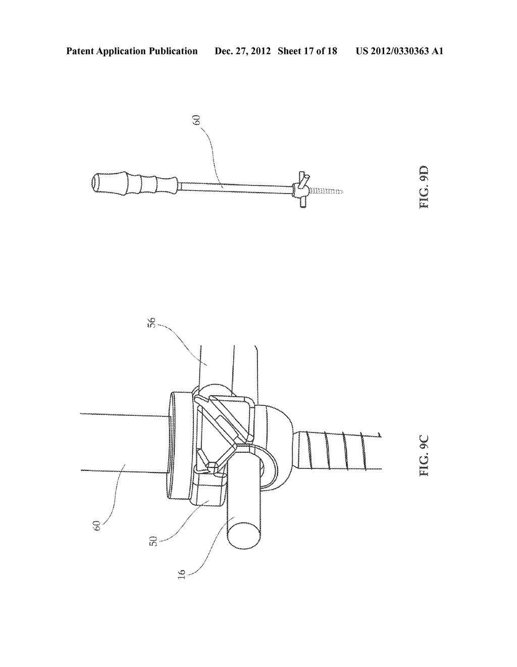 FASTENER ASSEMBLY THAT FASTENS TO POLYAXIAL PEDICLE SCREW - diagram, schematic, and image 18