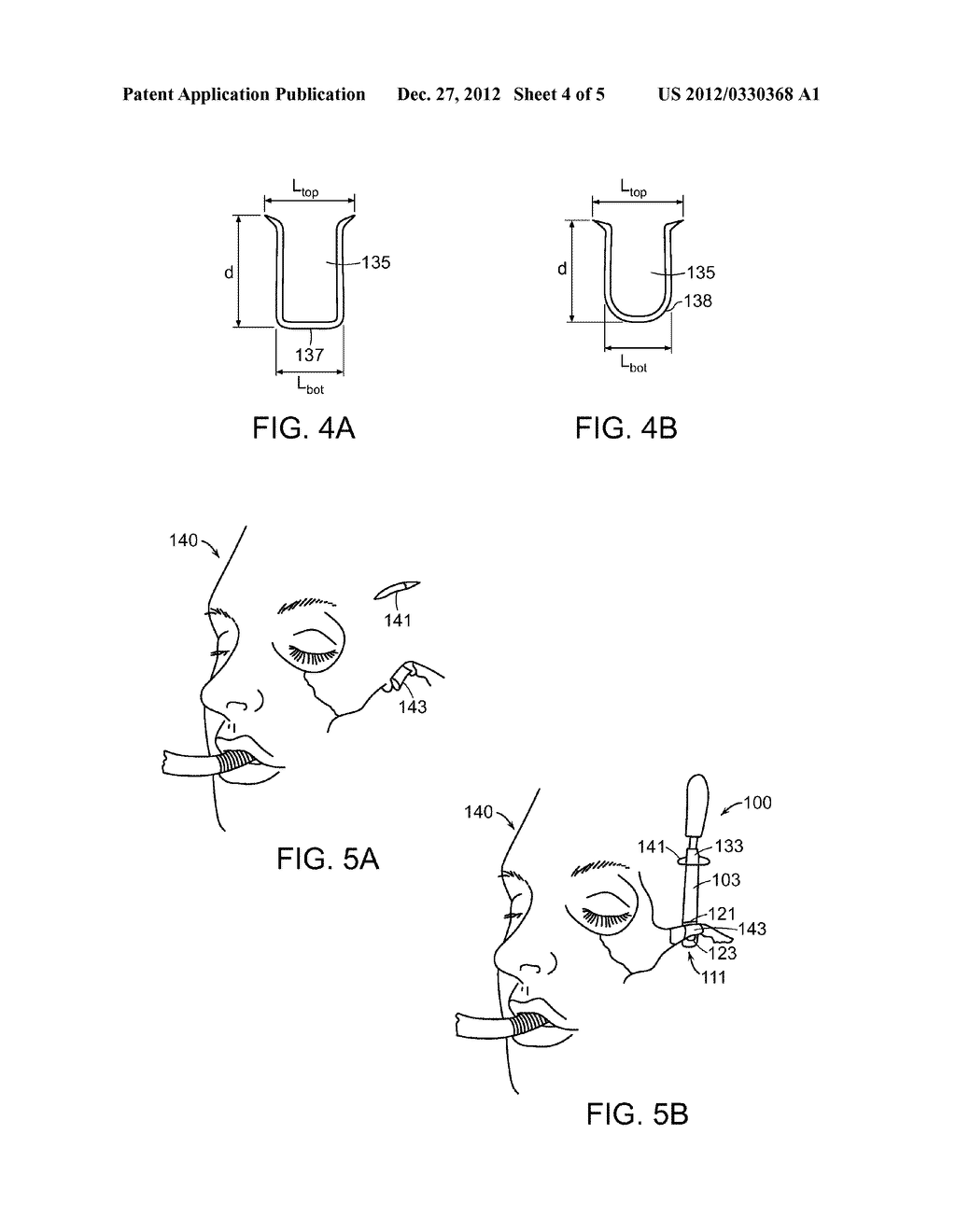 ZYGOMATIC ELEVATOR DEVICE AND METHODS - diagram, schematic, and image 05