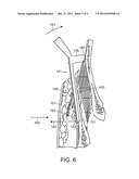 ZYGOMATIC ELEVATOR DEVICE AND METHODS diagram and image