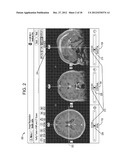 SYSTEM AND METHOD FOR DETERMINING TARGET STIMULATION VOLUMES diagram and image