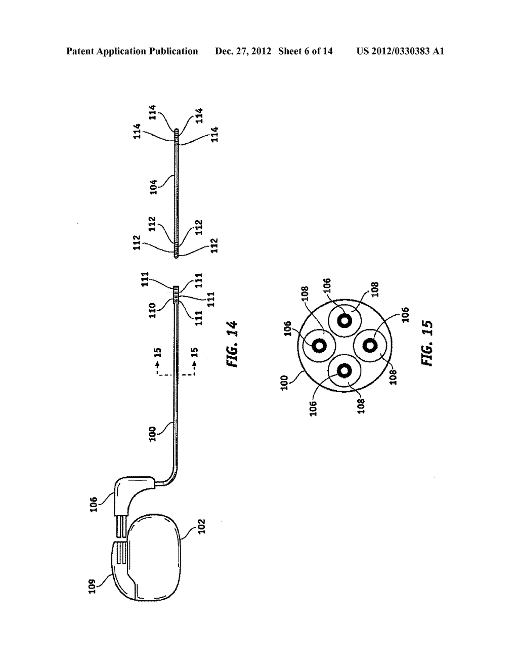 Extensible Implantable Medical Lead - diagram, schematic, and image 07