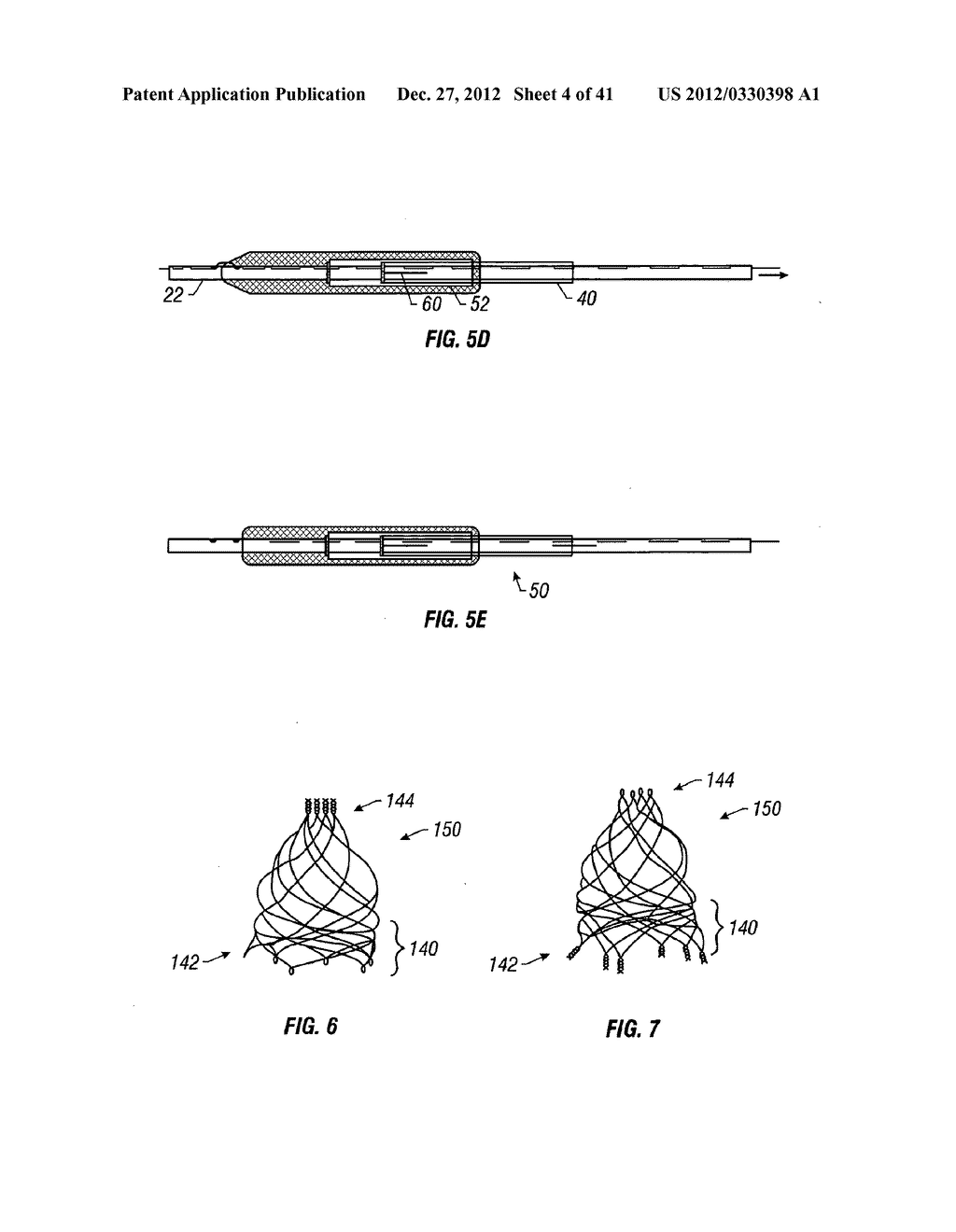 PLAIN WOVEN STENTS - diagram, schematic, and image 05