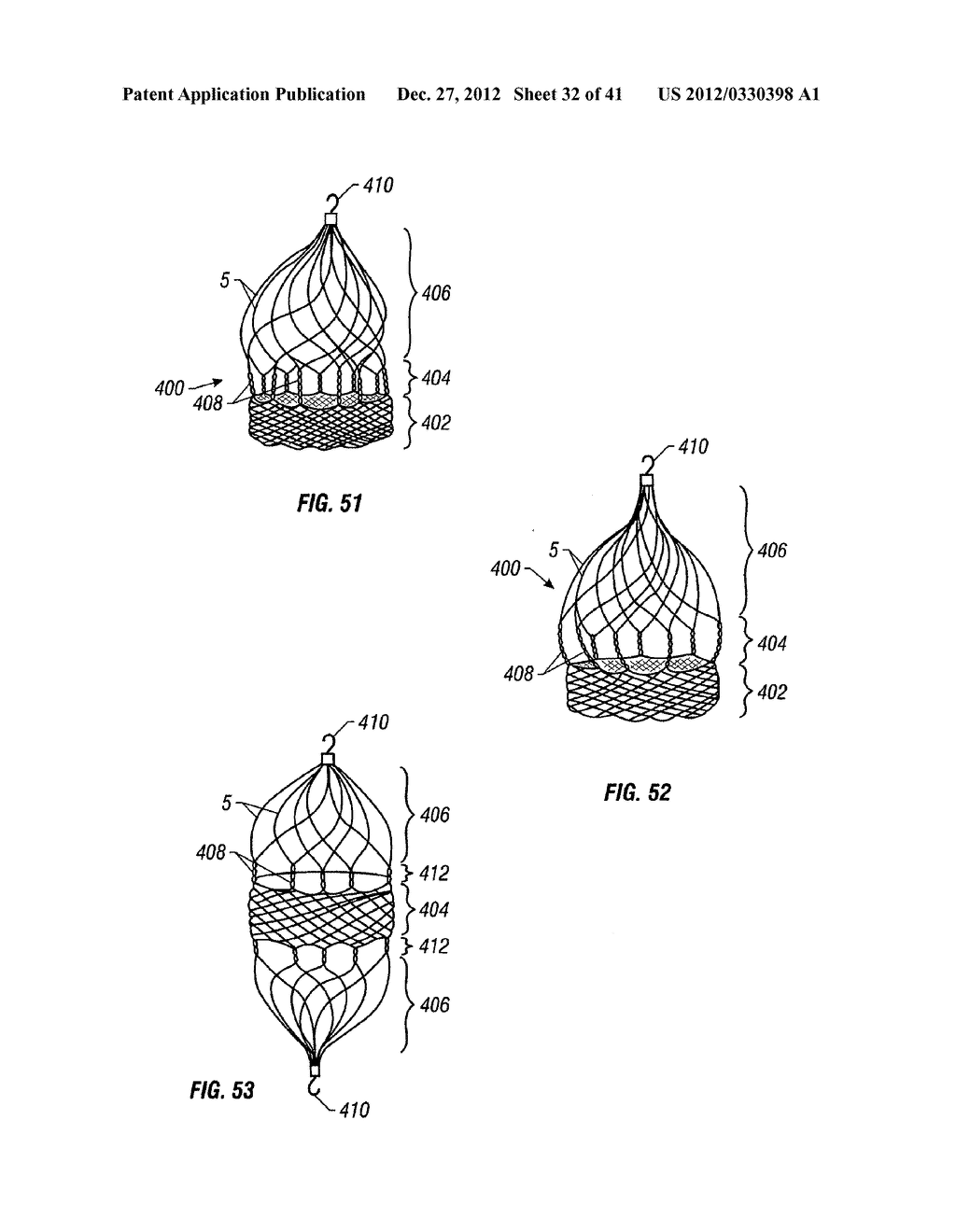 PLAIN WOVEN STENTS - diagram, schematic, and image 33