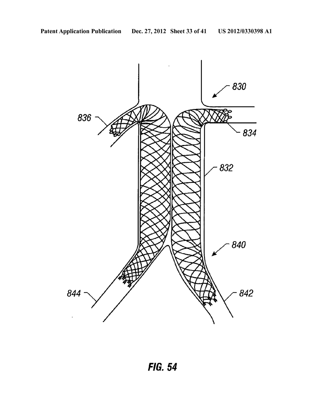 PLAIN WOVEN STENTS - diagram, schematic, and image 34