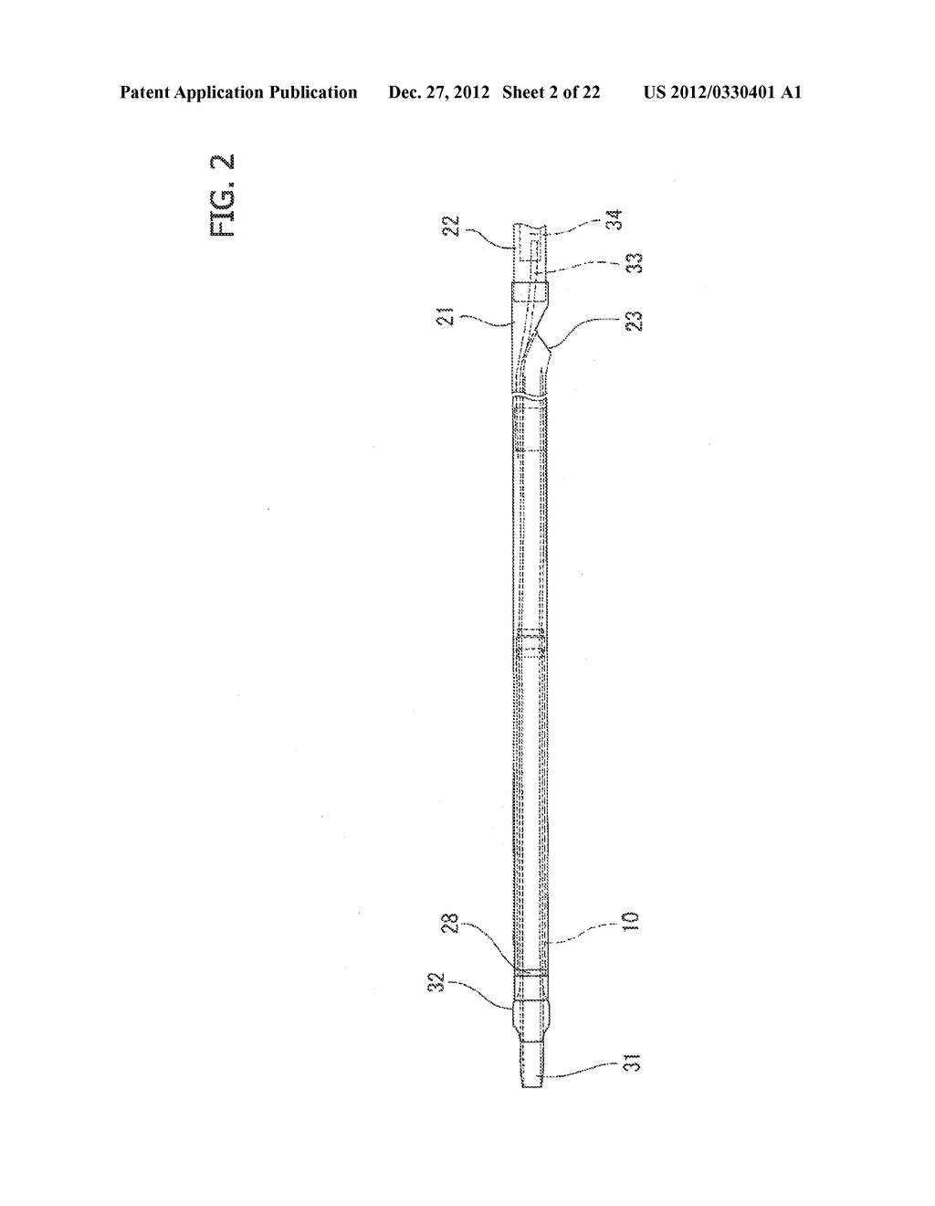 STENT DELIVERY SYSTEM - diagram, schematic, and image 03