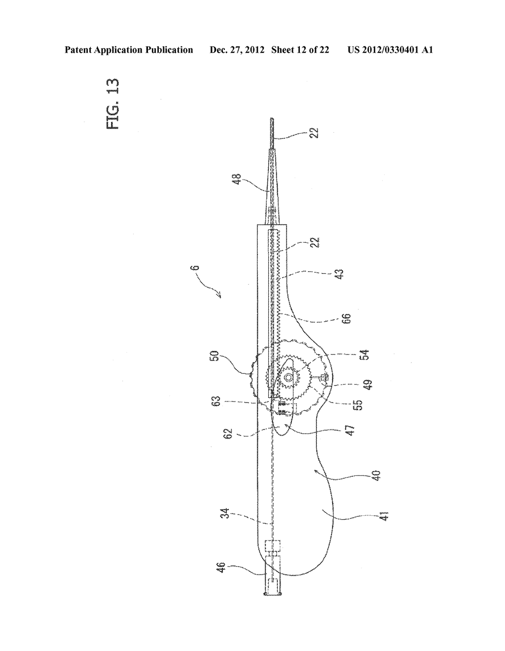 STENT DELIVERY SYSTEM - diagram, schematic, and image 13