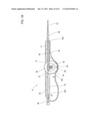 STENT DELIVERY SYSTEM diagram and image