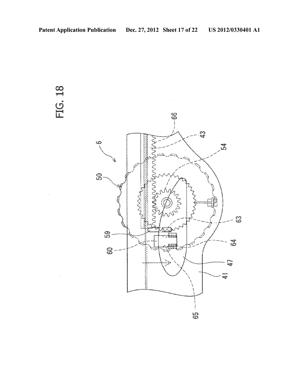 STENT DELIVERY SYSTEM - diagram, schematic, and image 18