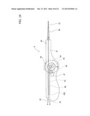 STENT DELIVERY SYSTEM diagram and image