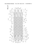 STENT DELIVERY SYSTEM diagram and image