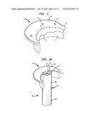 APPARATUS AND METHOD FOR HEART VALVE REPAIR diagram and image