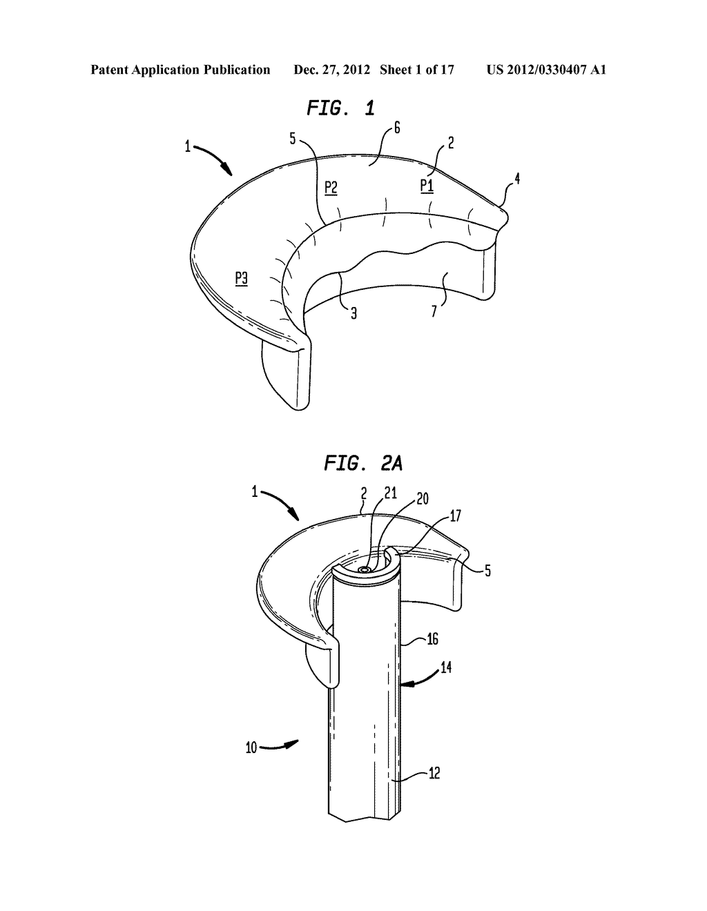 APPARATUS AND METHOD FOR HEART VALVE REPAIR - diagram, schematic, and image 02