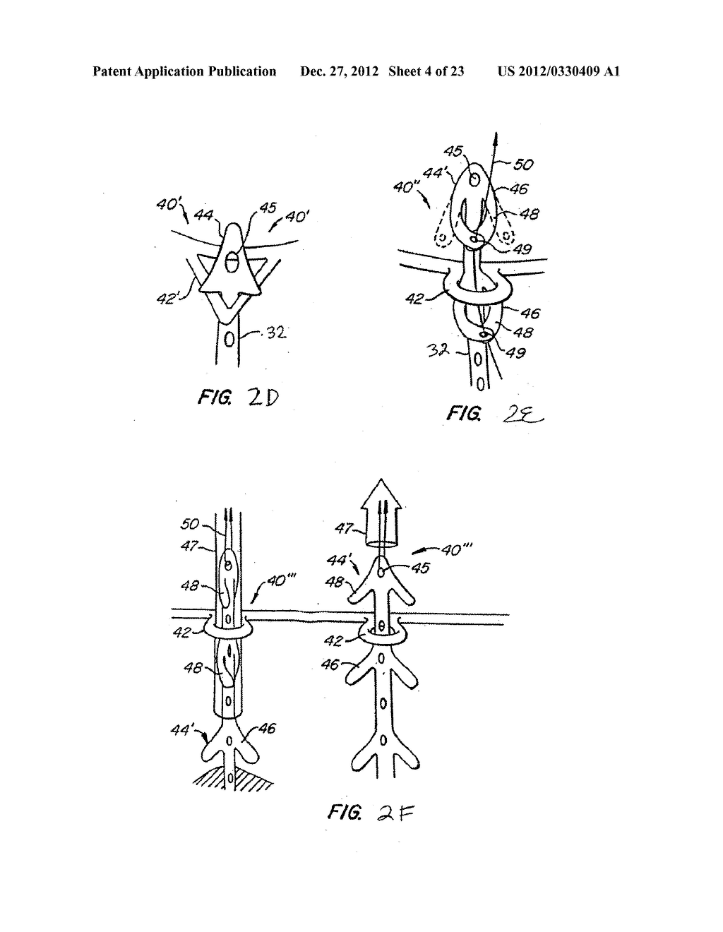 Methods and Apparatus for Endovascularly Replacing a Patient's Heart Valve - diagram, schematic, and image 05