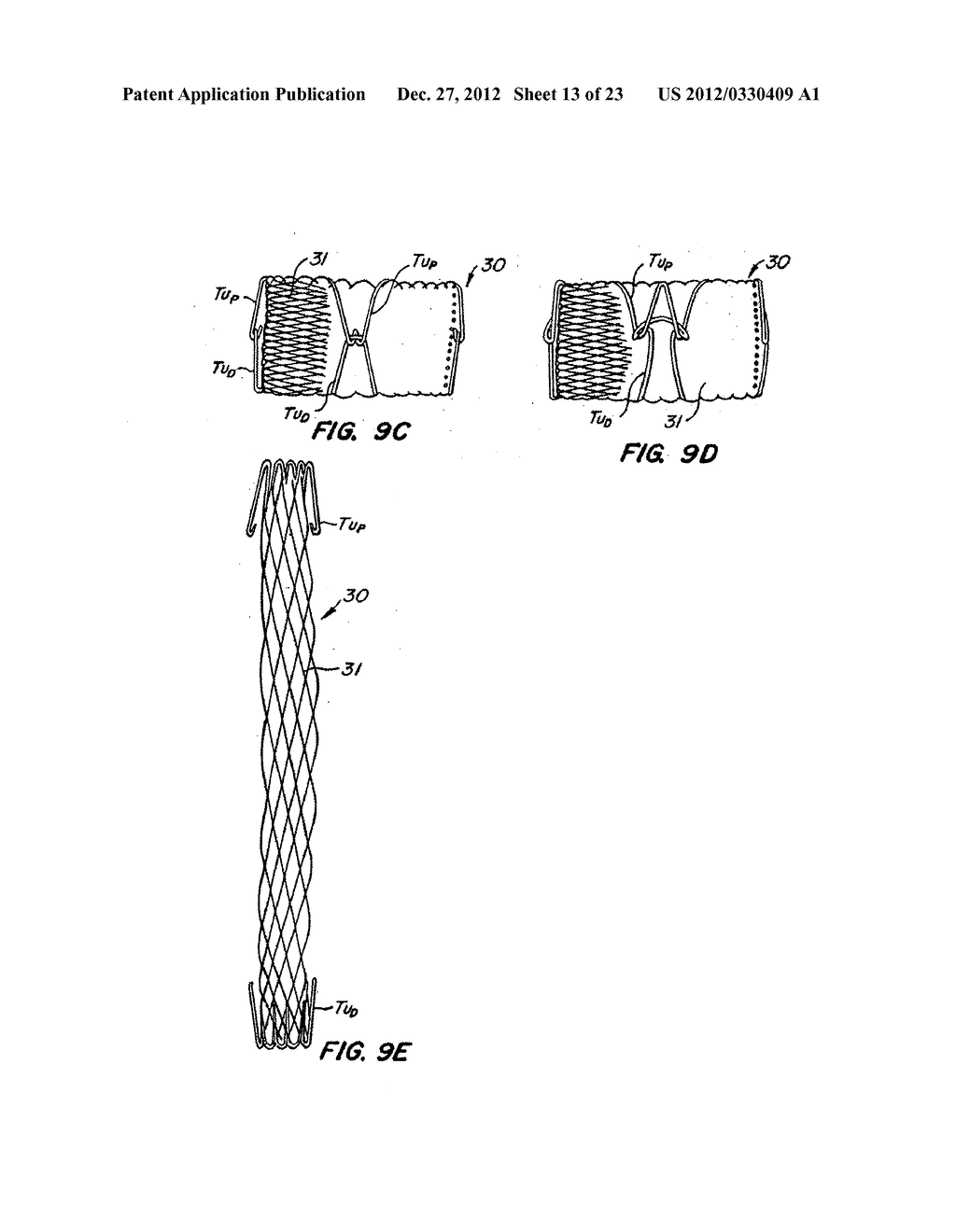 Methods and Apparatus for Endovascularly Replacing a Patient's Heart Valve - diagram, schematic, and image 14