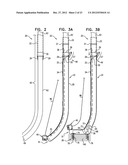 CLOSURE ELEMENT FOR USE WITH AN ANNULOPLASTY STRUCTURE diagram and image