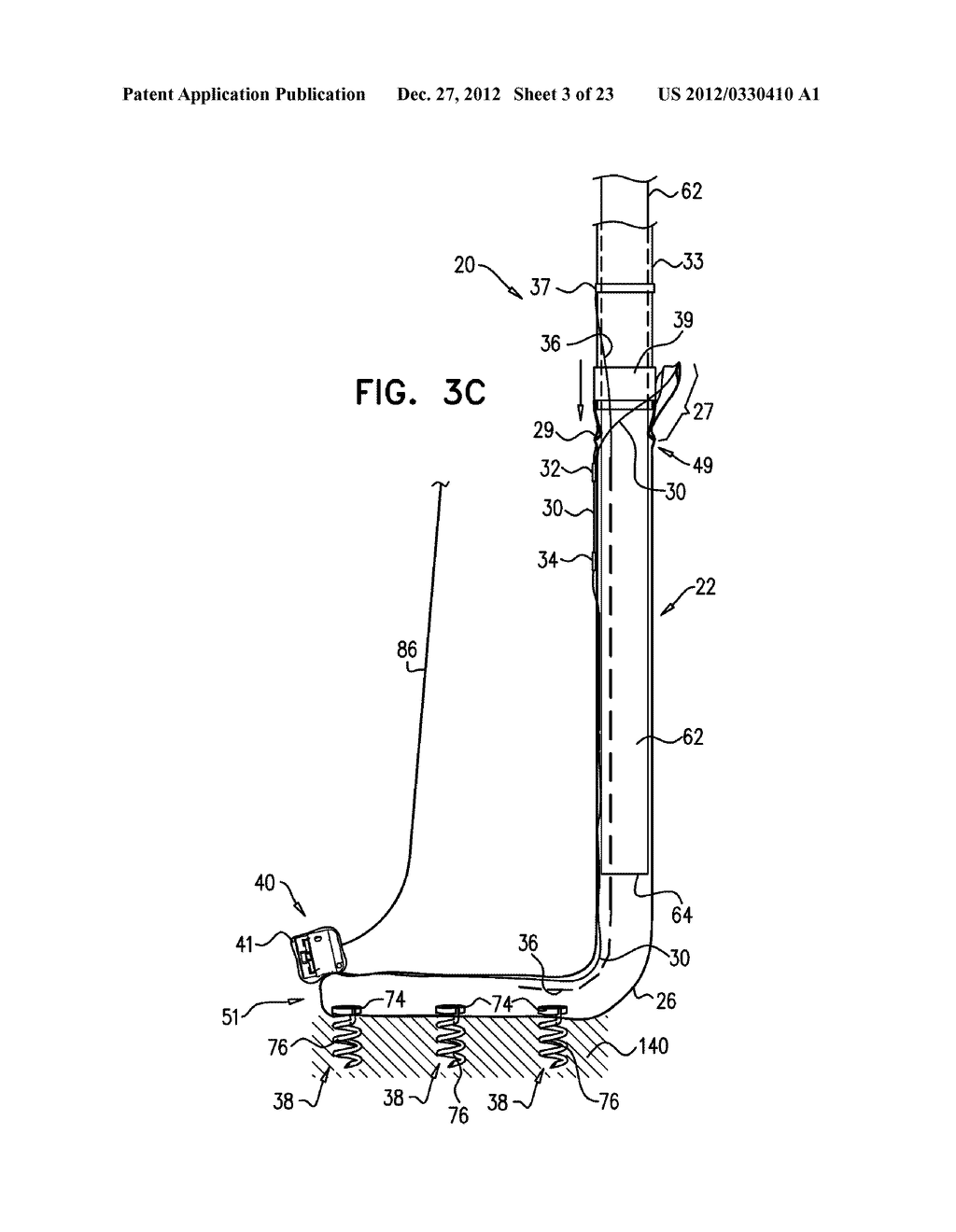 CLOSURE ELEMENT FOR USE WITH AN ANNULOPLASTY STRUCTURE - diagram, schematic, and image 04