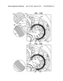 CLOSURE ELEMENT FOR USE WITH AN ANNULOPLASTY STRUCTURE diagram and image