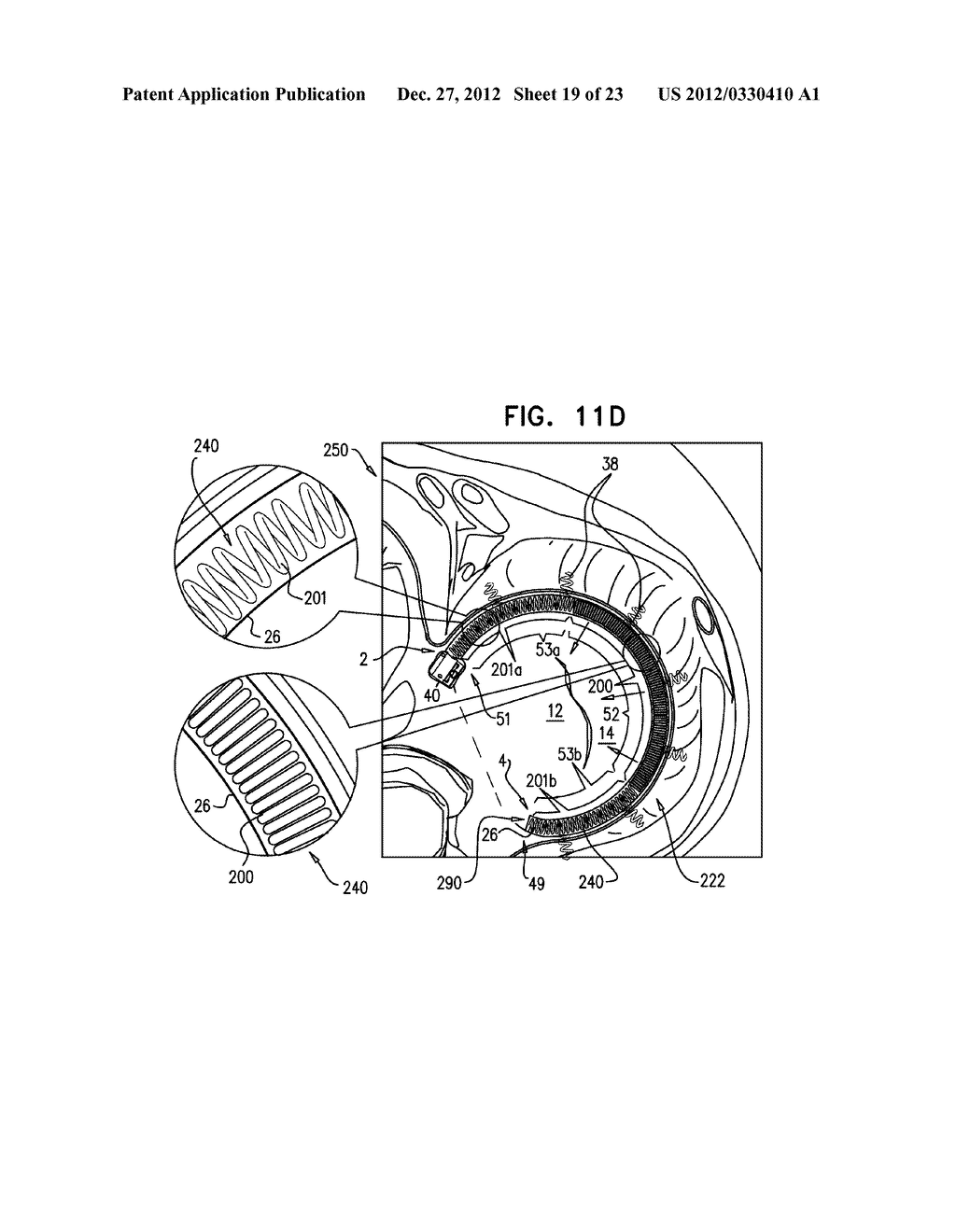 CLOSURE ELEMENT FOR USE WITH AN ANNULOPLASTY STRUCTURE - diagram, schematic, and image 20