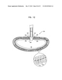 CLOSURE ELEMENT FOR USE WITH AN ANNULOPLASTY STRUCTURE diagram and image