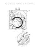 CLOSURE ELEMENT FOR USE WITH AN ANNULOPLASTY STRUCTURE diagram and image