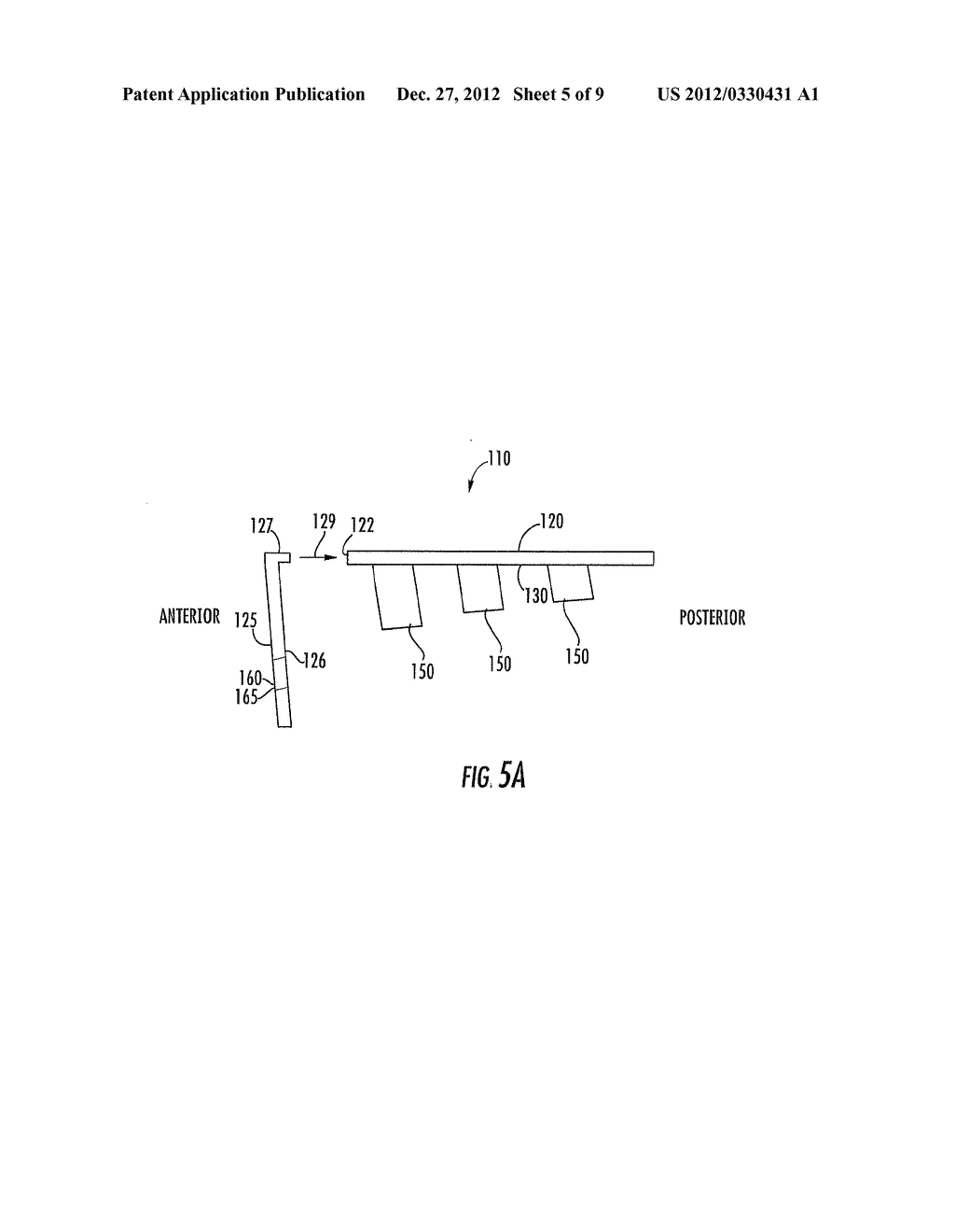 DEVICE FOR UNICOMPARTMENTAL KNEE ARTHROPLASTY - diagram, schematic, and image 06