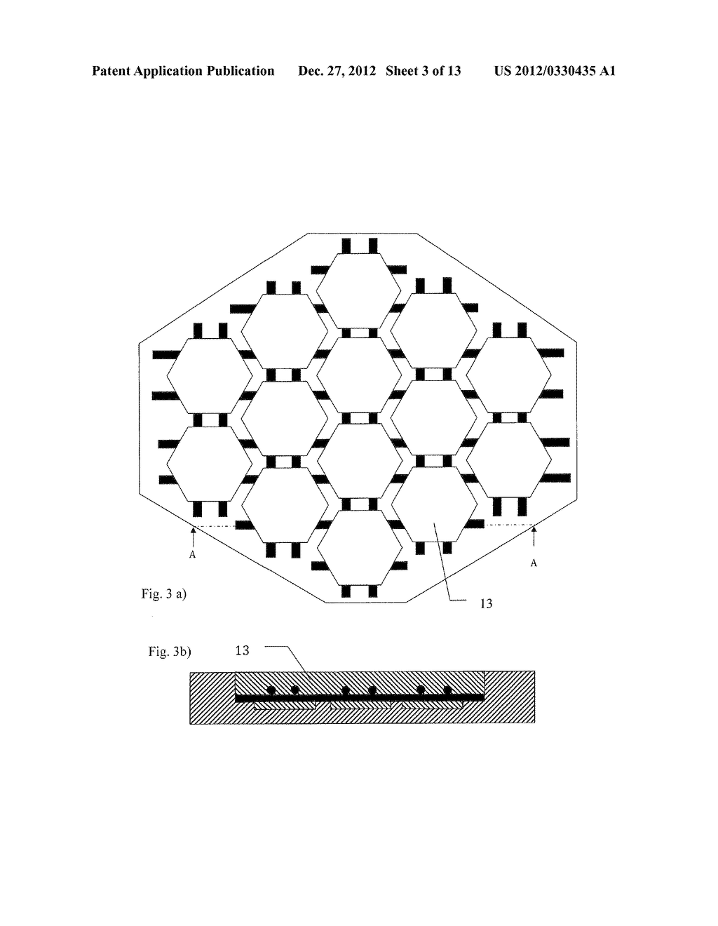 Implants and Methods for Correcting Tissue Defects - diagram, schematic, and image 04