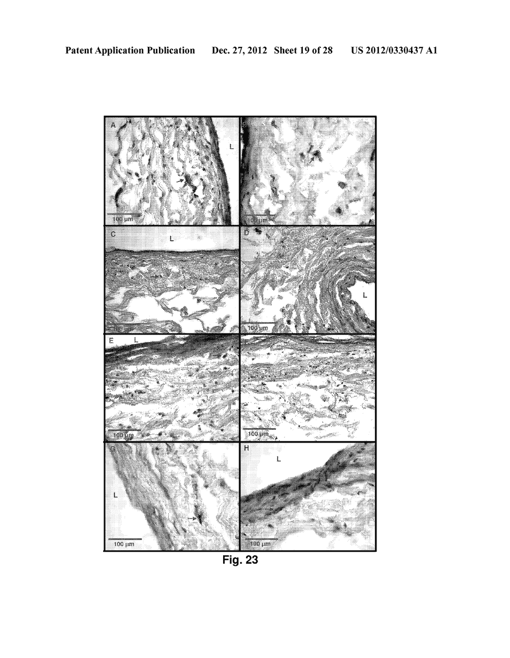 BIOERODIBLE WRAPS AND USES THEREFOR - diagram, schematic, and image 20