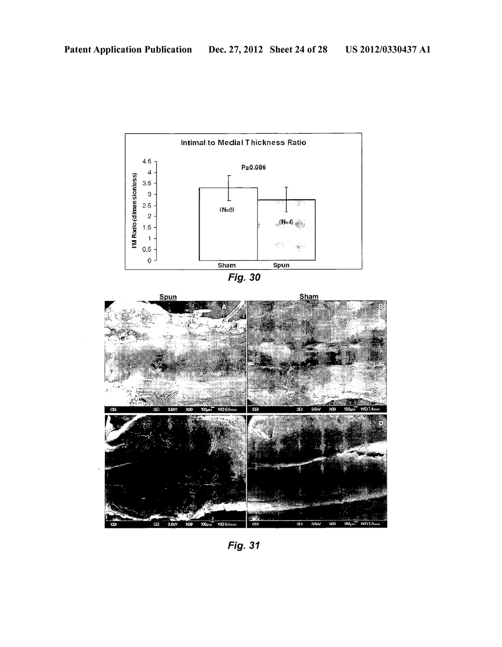 BIOERODIBLE WRAPS AND USES THEREFOR - diagram, schematic, and image 25