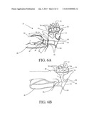 SECURING APPARATUS FOR A HAND PROTECTIVE DEVICE diagram and image