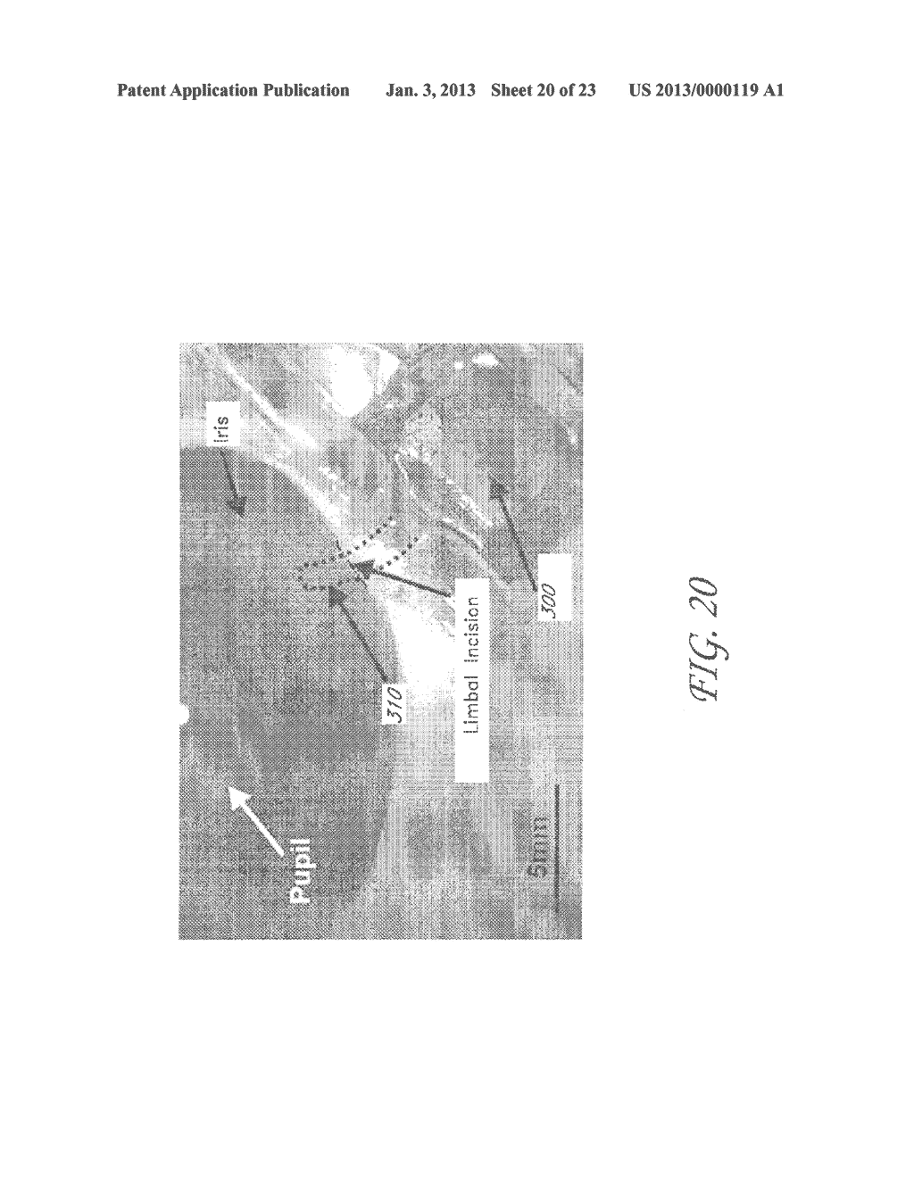 MEMS DEVICE AND METHOD FOR DELIVERY OF THERAPEUTIC AGENTS - diagram, schematic, and image 21