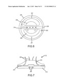 METAL BODIES CONTAINING MICROCAVITIES AND APPARATUS AND METHODS RELATING     THERETO diagram and image