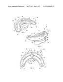 ORAL ORTHOSIS diagram and image