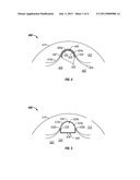 DRILLING MOTORS WITH ELASTICALLY DEFORMABLE LOBES diagram and image