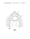 UNITIZED PACKAGE AND METHOD OF MAKING SAME diagram and image